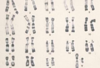 Caryotype humain mâle.
