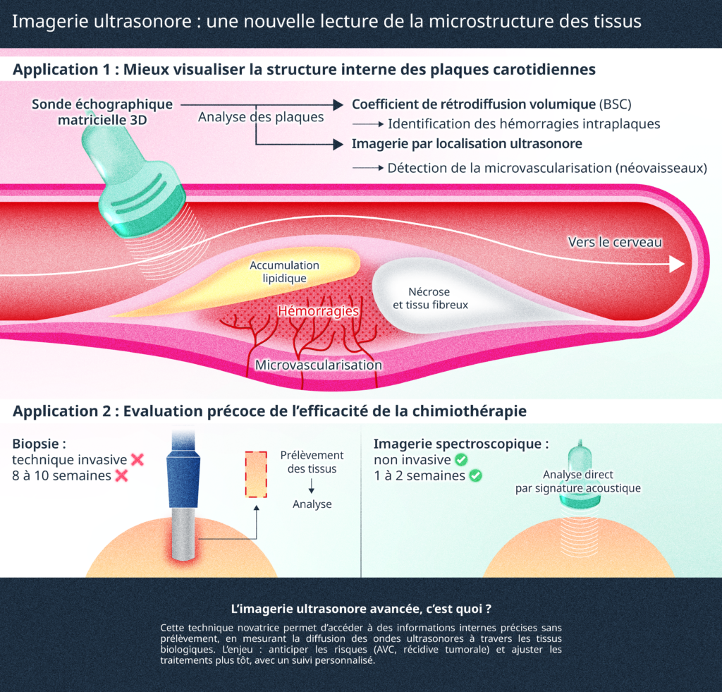 Imagerie ultrasonore&nbsp;: une nouvelle lecture de la microstructure des tissus © Emilie Josse