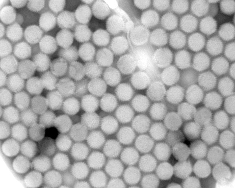 Adénovirus extraits de cellules humaines infectées, vus en microscopie électronique.